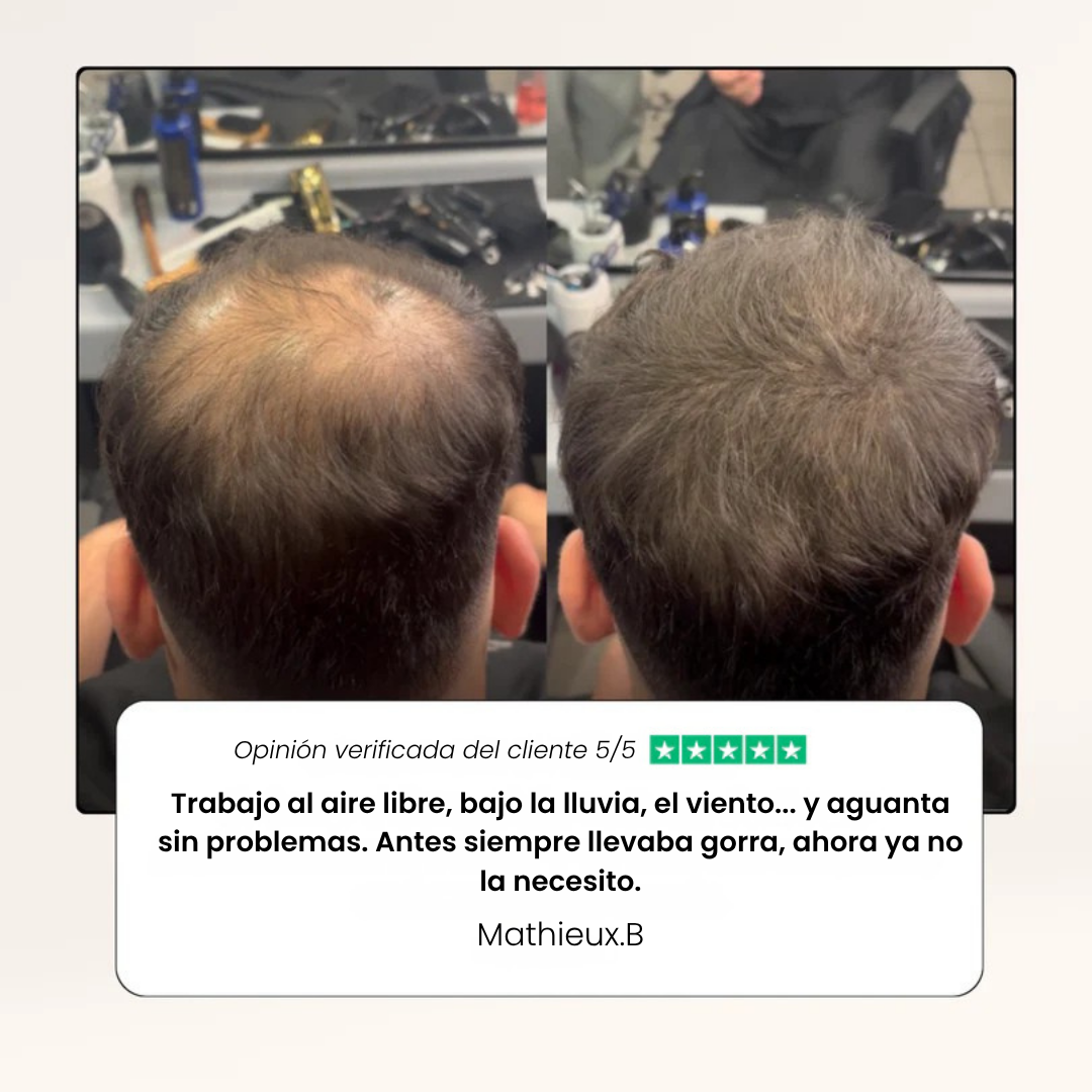 Camuflaje capilar