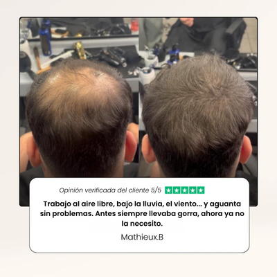 Camuflaje capilar